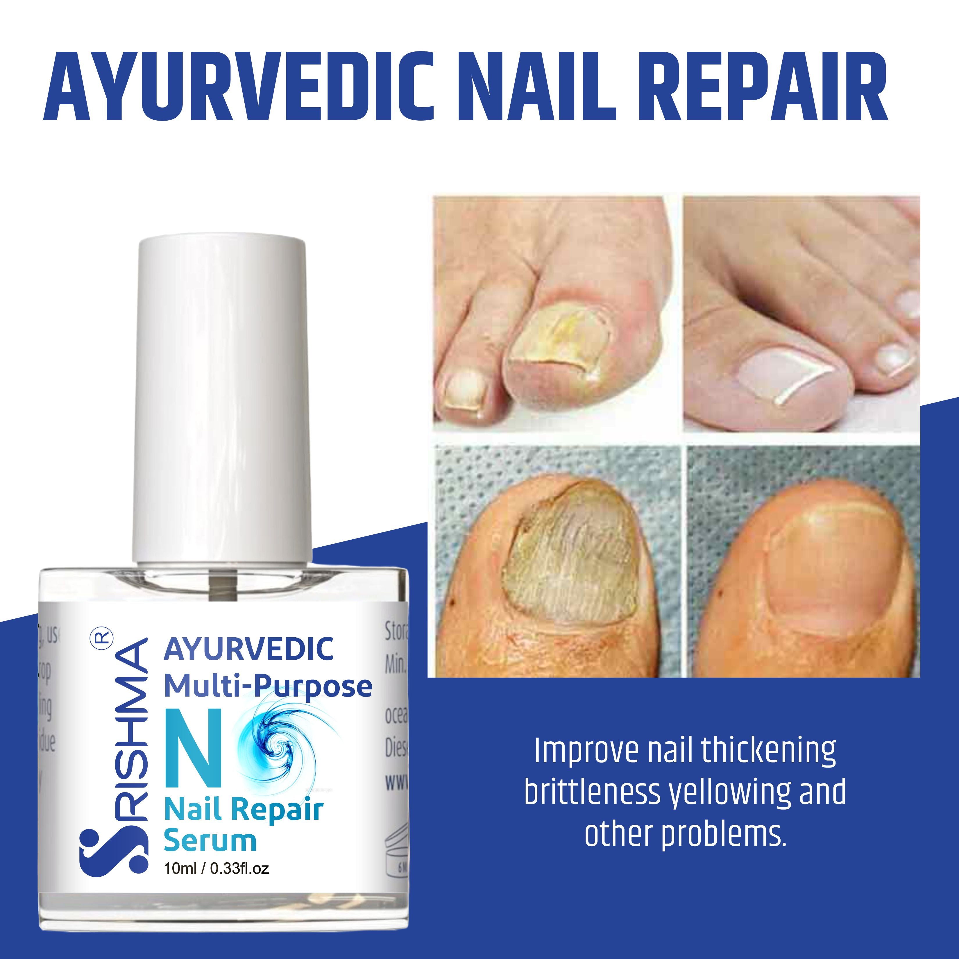 Nail Repair Serum for Stimulates Nail Growth, For Damaged Skin & Thin Nails